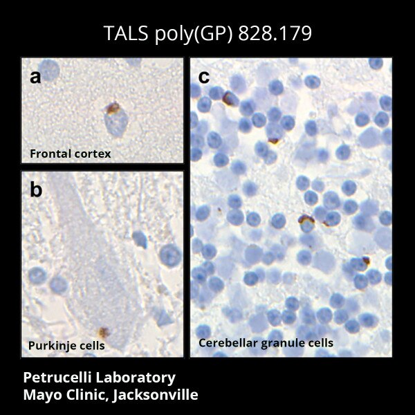 C9ORF72 Antibody (poly(GP) TALS 828.179) - DSHB
