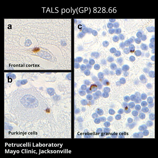 C9ORF72 Antibody (poly(GP) TALS 828.66) - DSHB